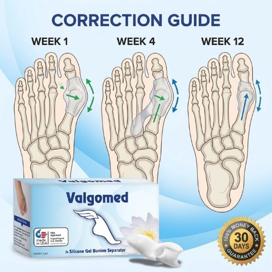 Picture of Valgomed 2x Silicone Gel Bunion Hallux Valgus Separator Fixative bales Toes