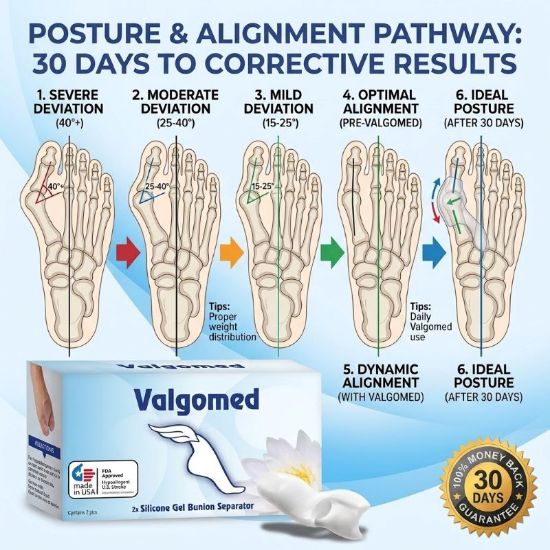 Picture of Valgomed 2x Silicone Gel Bunion Hallux Valgus Separator Fixative bales Toes